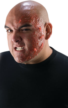 Burn Scar